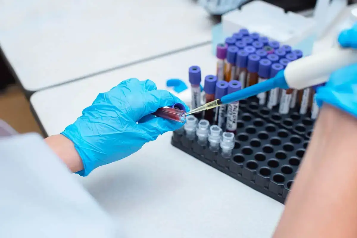 Hormone Testing vy Wellness Co