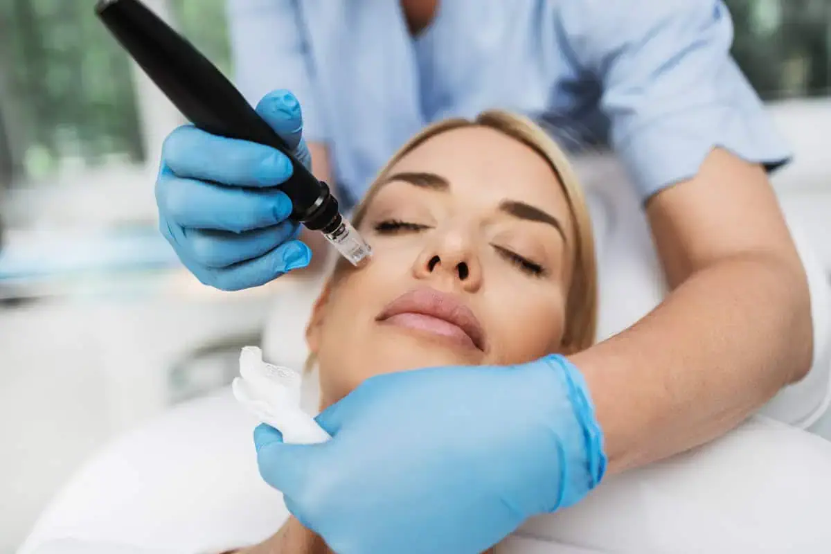 Microneedling in Zeeland, MI