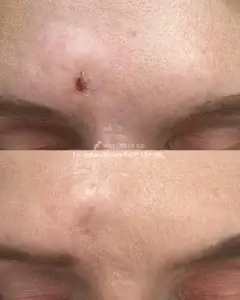 visitwellness-before-after-1