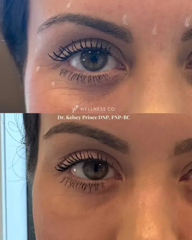 Visit Wellness Before & After Treatment