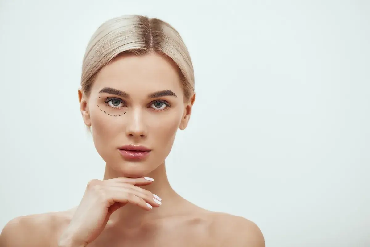 PRF Under Eye Treatment for reducing dark circles and under-eye hollows